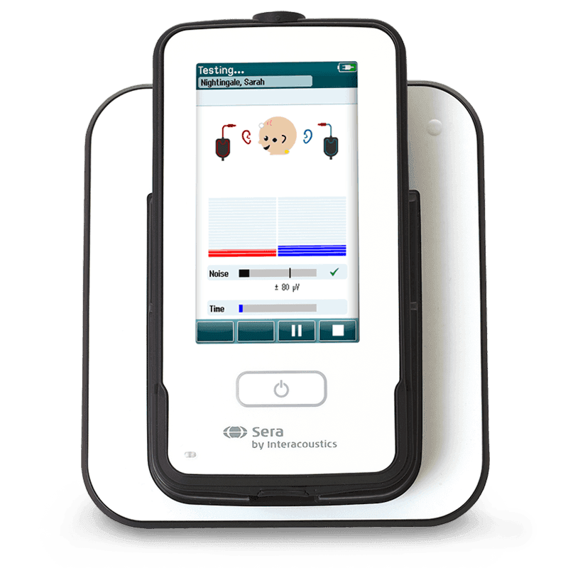 Interacoustics Sera, et auditive brainstem response og otoakustiske emissioner målingssystem med en stor skærm, der viser auditive data